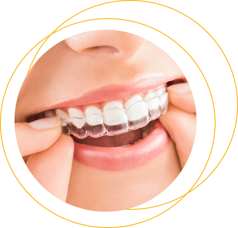 CONVÊNIO DENTISTA DE APARELHOS ORTODÔNTICOS